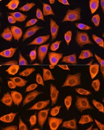 Anti-LASP1 antibody used in Immunocytochemistry/ Immunofluorescence (ICC/IF). GTX64762
