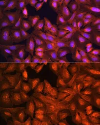Anti-LASP1 antibody used in Immunocytochemistry/ Immunofluorescence (ICC/IF). GTX64762