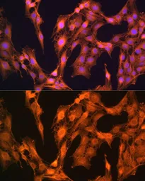 Anti-LASP1 antibody used in Immunocytochemistry/ Immunofluorescence (ICC/IF). GTX64762