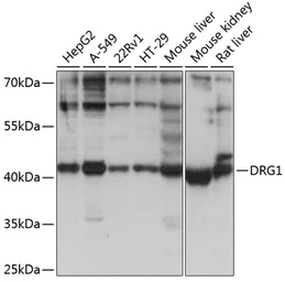 Anti-DRG1 antibody used in Western Blot (WB). GTX64763