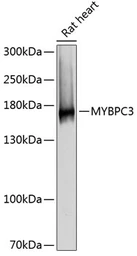 Anti-MYBPC3 antibody used in Western Blot (WB). GTX64768