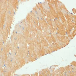 Anti-MYBPC3 antibody used in IHC (Paraffin sections) (IHC-P). GTX64768