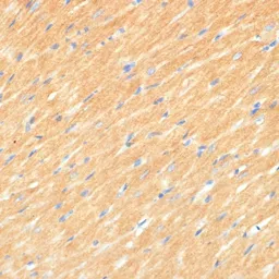 Anti-MYBPC3 antibody used in IHC (Paraffin sections) (IHC-P). GTX64768
