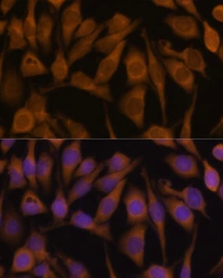 Anti-UBQLN2 antibody used in Immunocytochemistry/ Immunofluorescence (ICC/IF). GTX64773