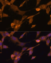 Anti-UBQLN2 antibody used in Immunocytochemistry/ Immunofluorescence (ICC/IF). GTX64773