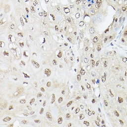 Anti-UBQLN2 antibody used in IHC (Paraffin sections) (IHC-P). GTX64773