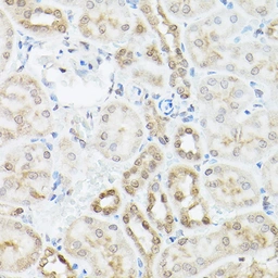 Anti-UBQLN2 antibody used in IHC (Paraffin sections) (IHC-P). GTX64773