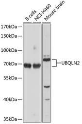 Anti-UBQLN2 antibody used in Western Blot (WB). GTX64773
