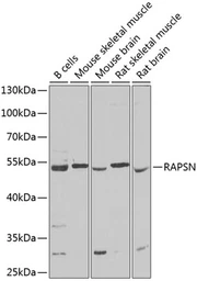 Anti-Rapsyn antibody used in Western Blot (WB). GTX64777