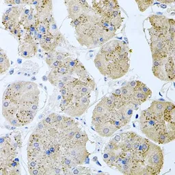 Anti-Rapsyn antibody used in IHC (Paraffin sections) (IHC-P). GTX64777