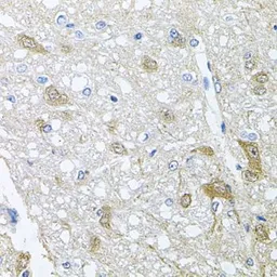 Anti-Rapsyn antibody used in IHC (Paraffin sections) (IHC-P). GTX64777