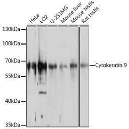 Anti-Cytokeratin 9 antibody used in Western Blot (WB). GTX64779