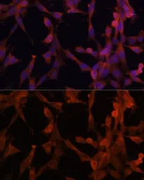 Anti-UBE2G2 antibody used in Immunocytochemistry/ Immunofluorescence (ICC/IF). GTX64782