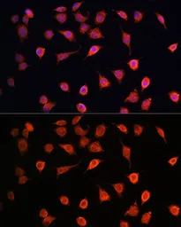 Anti-MRPS27 antibody used in Immunocytochemistry/ Immunofluorescence (ICC/IF). GTX64786
