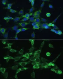 Anti-COX6A1 antibody used in Immunocytochemistry/ Immunofluorescence (ICC/IF). GTX64790