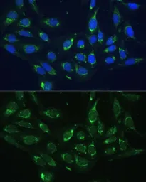 Anti-COX6A1 antibody used in Immunocytochemistry/ Immunofluorescence (ICC/IF). GTX64790