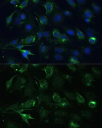 Anti-COX6A1 antibody used in Immunocytochemistry/ Immunofluorescence (ICC/IF). GTX64790