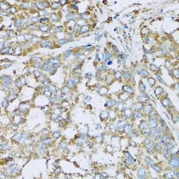 Anti-COX6A1 antibody used in IHC (Paraffin sections) (IHC-P). GTX64790