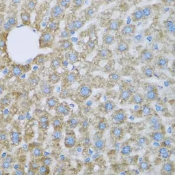 Anti-COX6A1 antibody used in IHC (Paraffin sections) (IHC-P). GTX64790