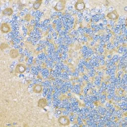 Anti-COX6A1 antibody used in IHC (Paraffin sections) (IHC-P). GTX64790