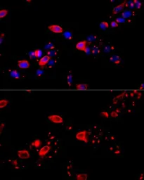 Anti-TCP1 theta antibody used in Immunocytochemistry/ Immunofluorescence (ICC/IF). GTX64792