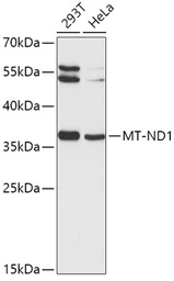 Anti-MT-ND1 antibody used in Western Blot (WB). GTX64794