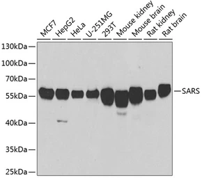Anti-Seryl-tRNA synthetase antibody used in Western Blot (WB). GTX64795