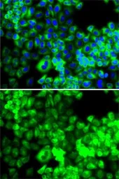 Anti-Seryl-tRNA synthetase antibody used in Immunocytochemistry/ Immunofluorescence (ICC/IF). GTX64795