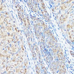Anti-Seryl-tRNA synthetase antibody used in IHC (Paraffin sections) (IHC-P). GTX64795