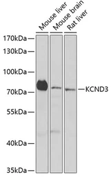 Anti-Kv4.3 antibody used in Western Blot (WB). GTX64796