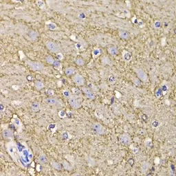 Anti-Kv4.3 antibody used in IHC (Paraffin sections) (IHC-P). GTX64796