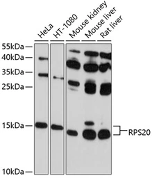 Anti-RPS20 antibody used in Western Blot (WB). GTX64800