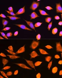 Anti-RPS20 antibody used in Immunocytochemistry/ Immunofluorescence (ICC/IF). GTX64800
