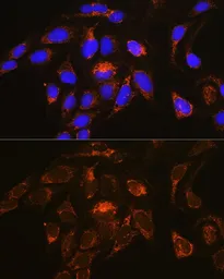 Anti-RAB13 antibody used in Immunocytochemistry/ Immunofluorescence (ICC/IF). GTX64803