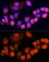 Anti-MSH4 antibody used in Immunocytochemistry/ Immunofluorescence (ICC/IF). GTX64804