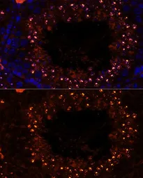 Anti-MSH4 antibody used in IHC (Paraffin sections) (IHC-P). GTX64804