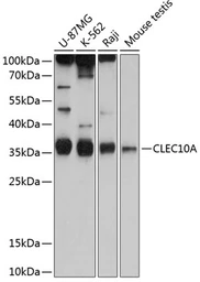 Anti-CLEC10A antibody used in Western Blot (WB). GTX64805