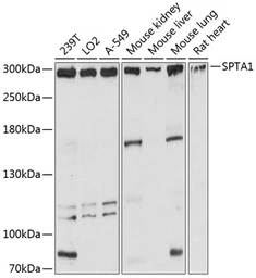 Anti-alpha 1 Spectrin antibody used in Western Blot (WB). GTX64806