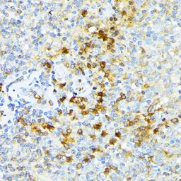 Anti-alpha 1 Spectrin antibody used in IHC (Paraffin sections) (IHC-P). GTX64806