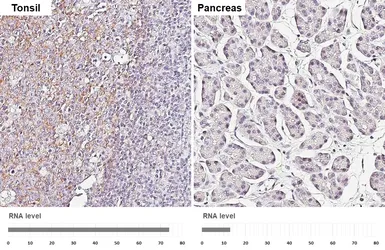 Anti-VCAM1 / CD106 antibody [HL5998] used in IHC (Paraffin sections) (IHC-P). GTX648072