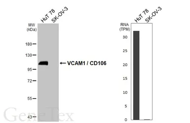 Anti-VCAM1 / CD106 antibody [HL5999] used in Western Blot (WB). GTX648073