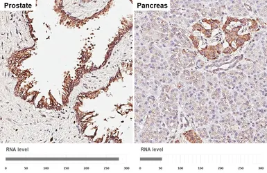 Anti-PSAP antibody [HL6003] used in IHC (Paraffin sections) (IHC-P). GTX648077