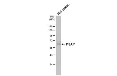 Anti-PSAP antibody [HL6003] used in Western Blot (WB). GTX648077
