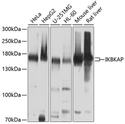 Anti-IKAP antibody used in Western Blot (WB). GTX64808