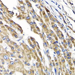 Anti-IKAP antibody used in IHC (Paraffin sections) (IHC-P). GTX64808