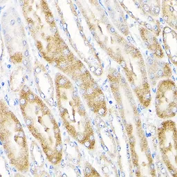 Anti-IKAP antibody used in IHC (Paraffin sections) (IHC-P). GTX64808