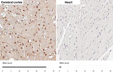 Anti-PHGDH antibody [HL6006] used in IHC (Paraffin sections) (IHC-P). GTX648080
