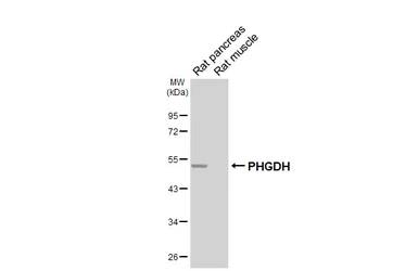 Anti-PHGDH antibody [HL6006] used in Western Blot (WB). GTX648080