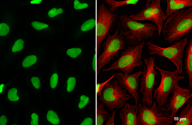 Anti-RCC1 antibody [HL6010] used in Immunocytochemistry/ Immunofluorescence (ICC/IF). GTX648084