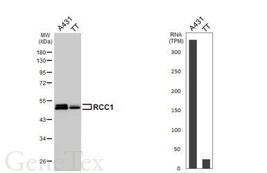 Anti-RCC1 antibody [HL6011] used in Western Blot (WB). GTX648085